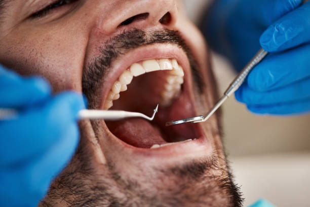Best Emergency Treatment for Jaw Pain or Injury in Overland, MO