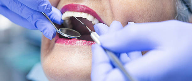 Best Emergency Denture Repair in Overland, MO